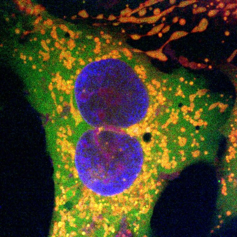 תאי אדם שעברו עריכת גנים באמצעות טכנולוגיית עריכת גנים חדשה המבוססת על רטרונים. הנקודות הכתומות מסמנות עריכות גנים מוצלחות. הנקודות הירוקות מראות תג של חלבון פלואורסצנטי על פני השטח של המיטוכונדריות. קרדיט: יו־צ׳יון צ׳אנג / אוניברסיטת טקסס באוסטין.