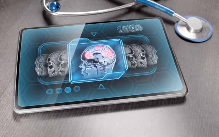 שימוש ב-fMRI. המחשה: depositphotos.com