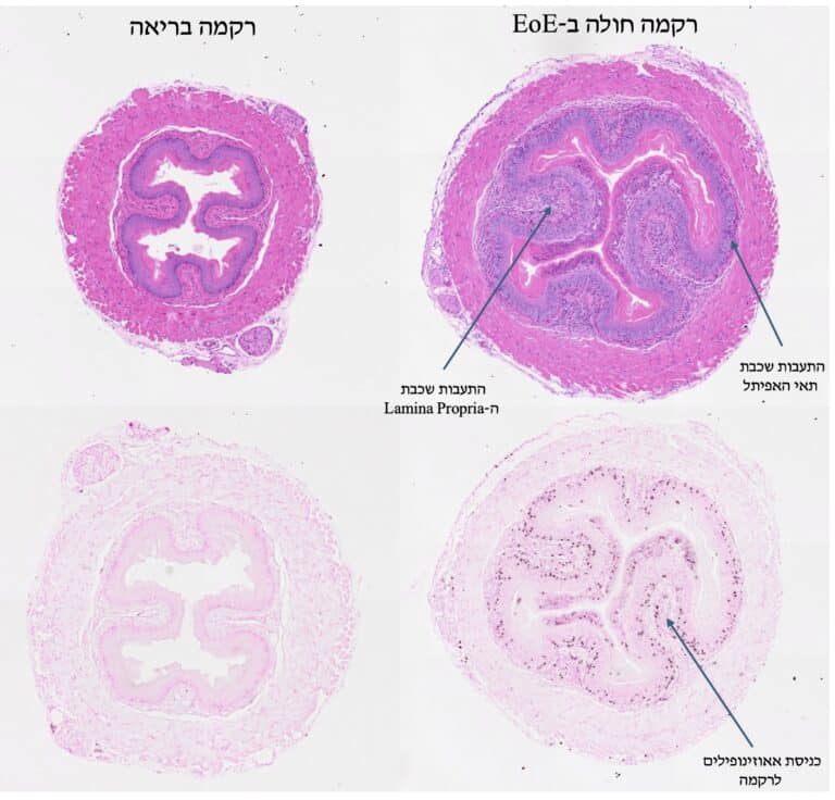 באדיבות פרופ' אריאל מוניץ