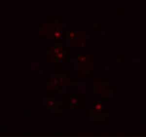 تجميع معقدات البروتين النووي الريبي استجابةً لظروف الإجهاد الشبيهة بظروف المريخ. حقوق الصورة: Dhage et al.