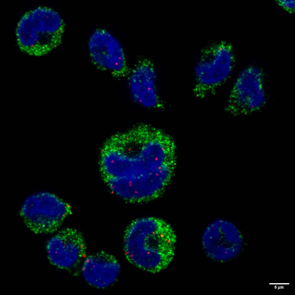 סודות הגרעין של טפיל המלריה: כך הטפיל חודר למרכז הפיקוד של תאי החיסון