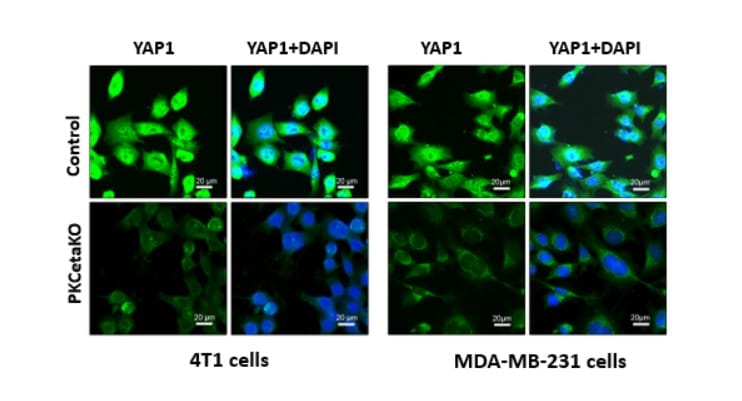 צביעה פלאורסנטית של החלבון  1YAP (בצבע ירוק) לצד גרעיני התא (בצבע כחול) בתאי בקרת ותאים החסרים את הביטוי של PKC-eta.  קרדיט צילום: ד״ר ליגו ויגאיה סטאלטר