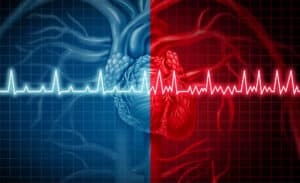 Atrial fibrillation. Illustration: depositphotos.com