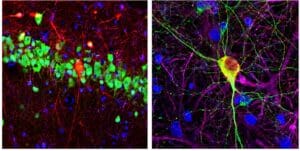 Neurons in rat brain and in culture after treatment with AAV vectors