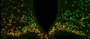 Otp protein expression in hunger-related neurons in the mouse hypothalamus