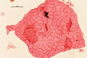 Fossil leaves reveal: Warming 56 million years ago thinned forest canopies