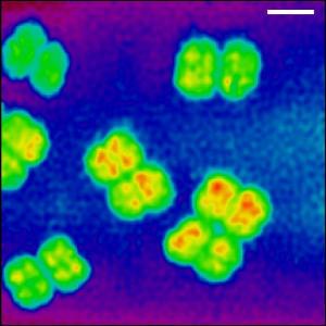 of biological cells using a technique for nanometer X-ray photography